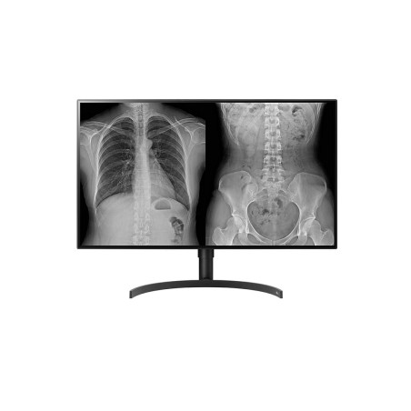 LG 32HL512D-M écran plat de PC 80 cm (31.5") 3840 x 2160 pi | JDB-Info